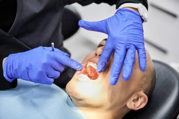 Best Emergency Dental Extractions in Ashton Sandy Spring, MD