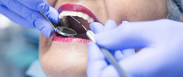 Best Emergency Dentist for Knocked-Out Tooth in Ashton Sandy Spring, MD